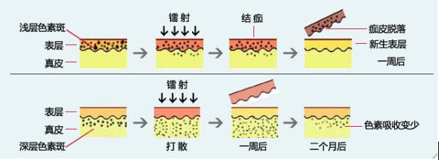 美莱白瓷娃娃