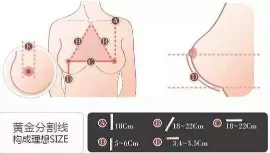 自体脂肪移植填充丰胸 做“挺”好女人